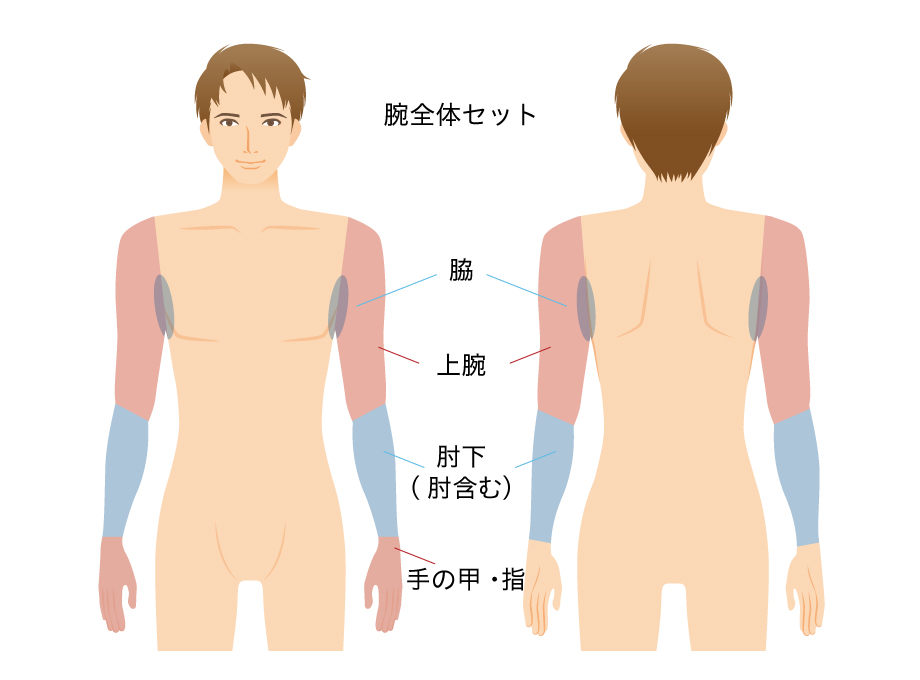 腕全体セット