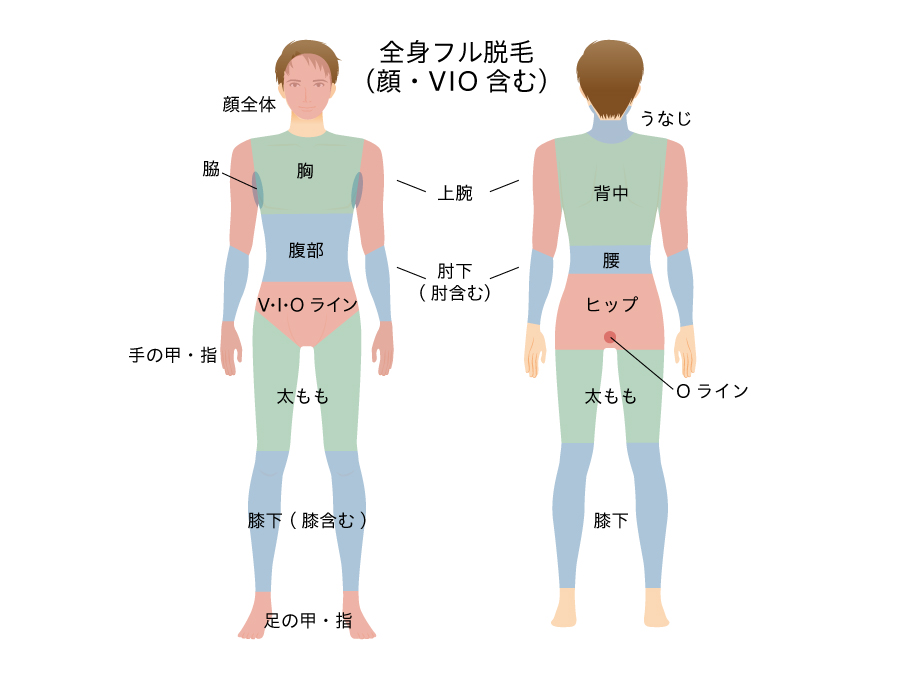 全身フル脱毛（VIOを含む）