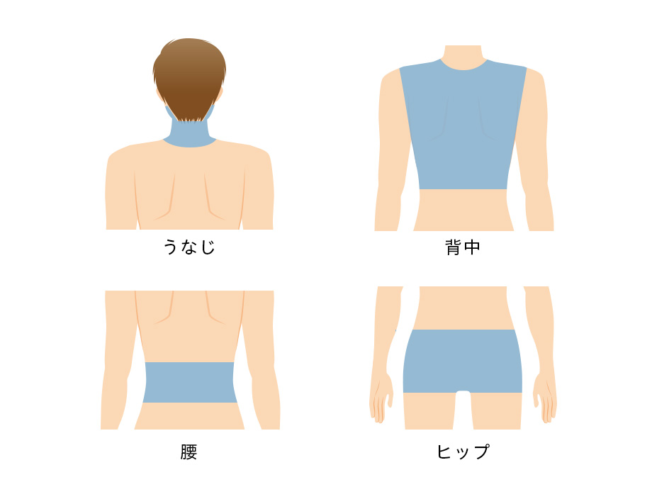 その他パーツ脱毛