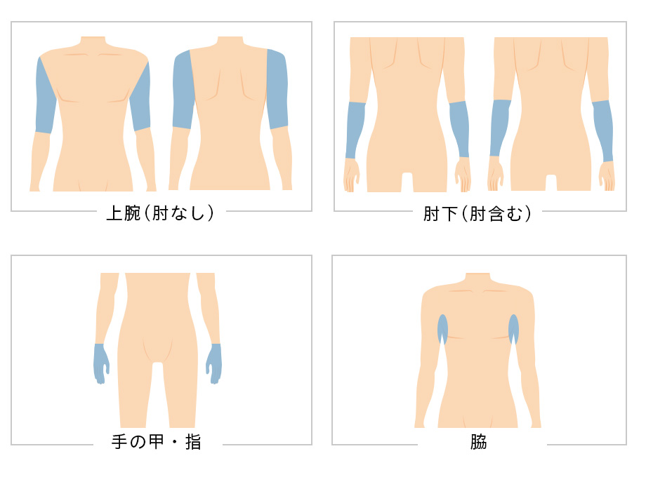 その他パーツ脱毛