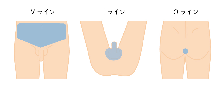 VIO