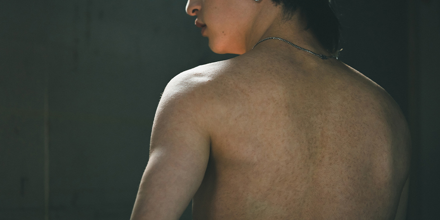 日焼け肌・色黒でも医療脱毛できる？